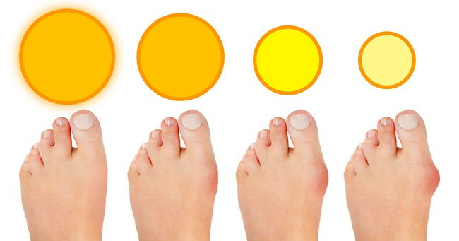 điều gì xảy ra khi bạn không tiếp xúc đủ với ánh nắng mặt trời? hình 3 dieu gi xay ra khi ban khong tiep xuc du voi anh nang mat troi? hinh 3
